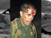 Three More Border Patrol Agents Assaulted in South Texas